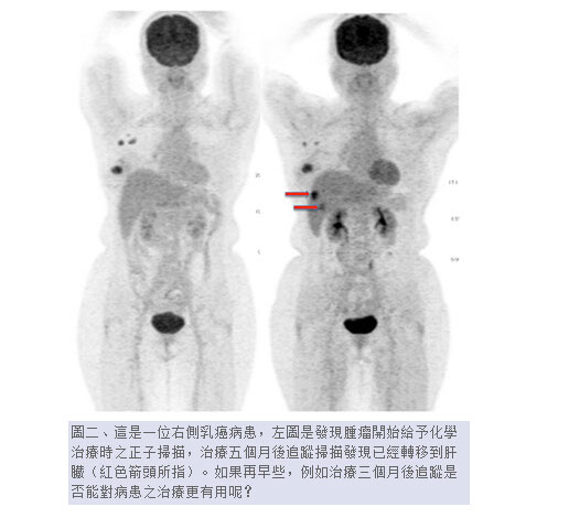 如这篇台湾医学论文截图里的用法，PET-CT技术主要在癌症治疗中大显身手