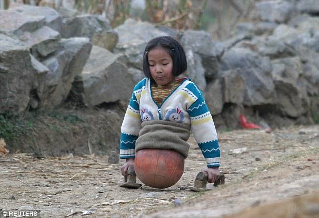 励志！无腿女孩靠篮球走路 屡夺游泳冠军(图)