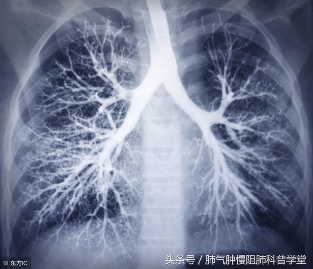 呼吸名医科普：治疗咳嗽的好方法有哪些