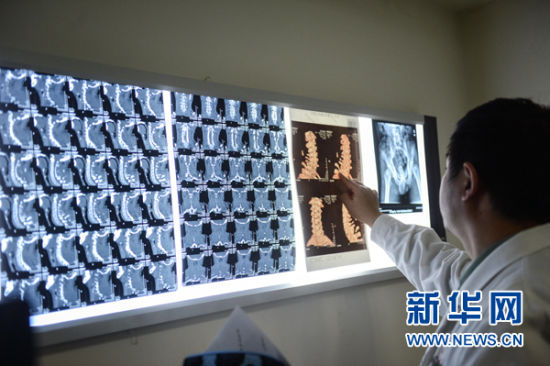 11月20日，专家在查看李迎福的CT诊断结果。新华社记者 徐昱摄